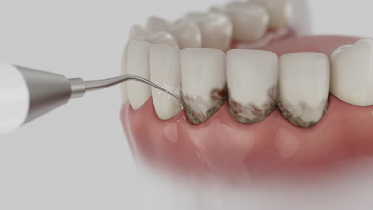 Reliable Dental Implants contractor in Brunswick, MD by Smile Center Dentistry